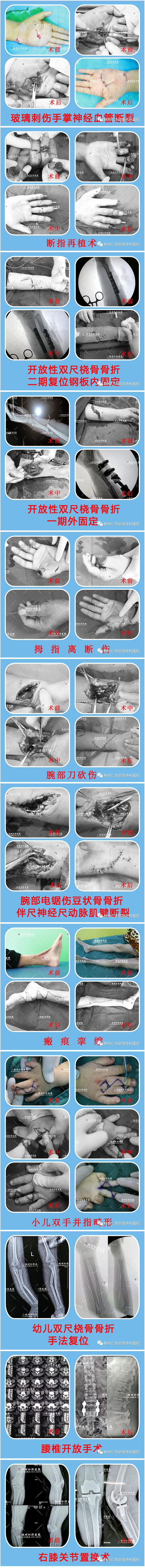 03_看图王